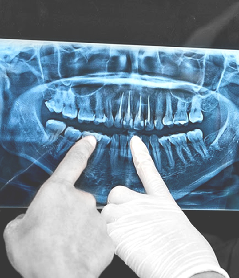 estetik diş-hekimliği